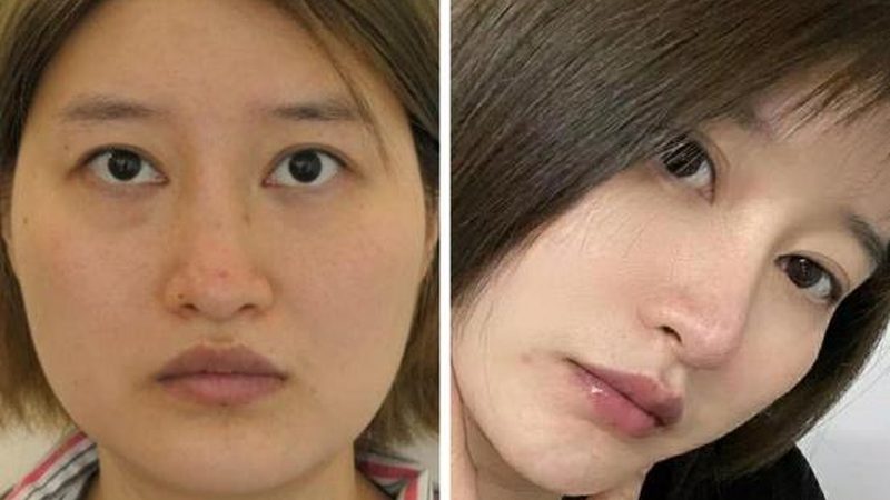 医美医生从业经验：揭秘背后的秘密