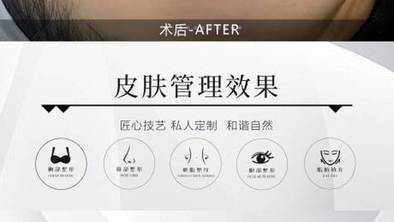 医美注射设备：揭秘参数背后的技术奥秘