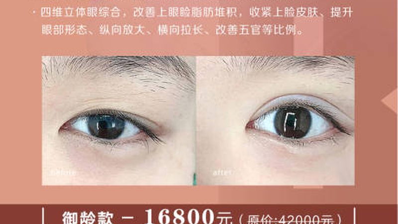 小型光子嫩肤机：揭秘价格背后的技术秘密