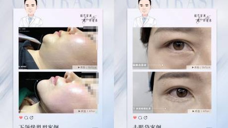 超声炮：揭秘其工作原理与价格构成