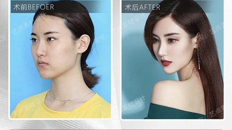 女生私处激光脱毛，疼痛体验揭秘