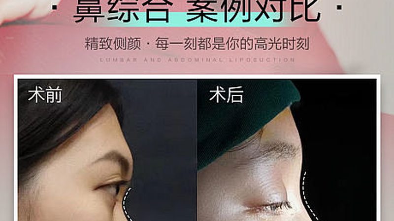 轻医美与微整形，揭秘操作流程背后的秘密