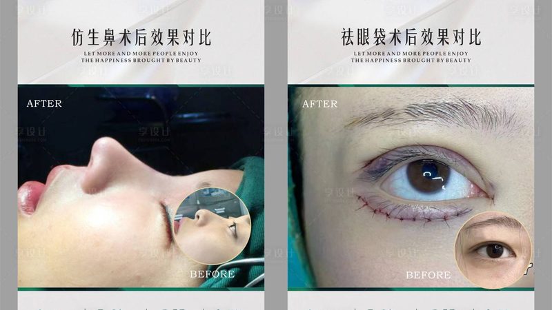 激光祛斑后皮肤干到起皮？问题出在补水方式上