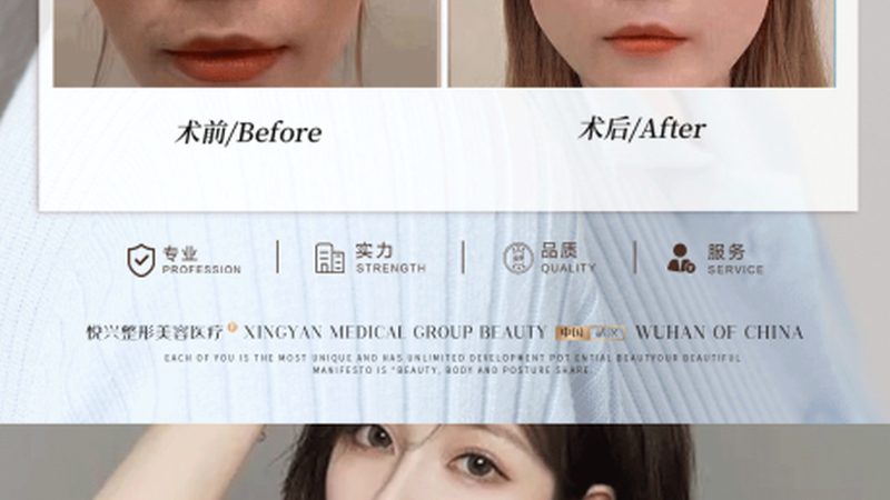 瘦脸操前后，这些产品你不可不知