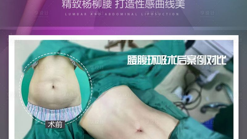 水光针注射，揭秘其专业操作流程