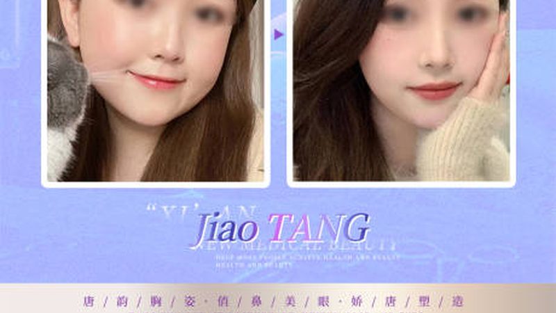 热玛吉效果能维持多久？揭秘其真实效果与维持时间