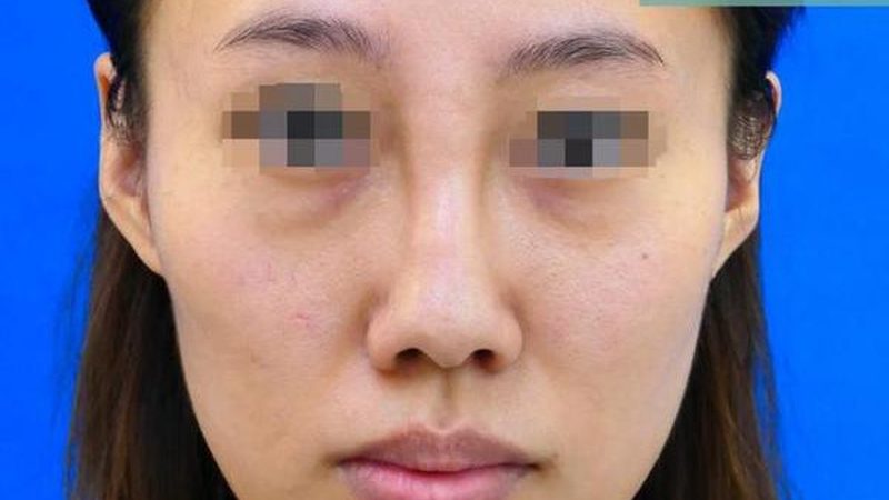 北京轻医美医院排名前十注射类项目
